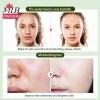 25g Aloe Vera Silk Mask, Korean moisturizing formula wholesale customization, pure cotton silk mask, natural Aloe vera sheet skin care mask Application Scenario